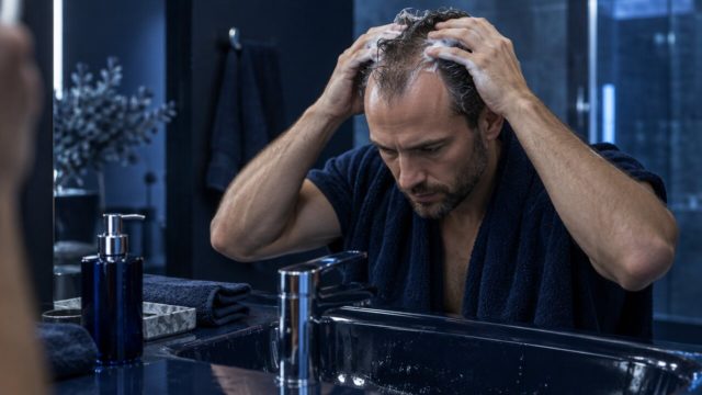 Ketoconazole Shampoo and Hair Transplant Preparation